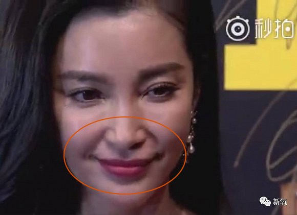 Sau hạ gò má thì phương pháp lấp đầy râu rồng sẽ giúp các chị em trẻ ra vài chục tuổi - Ảnh 3. Sau hạ gò má thì phương pháp lấp đầy râu rồng sẽ giúp các chị em trẻ ra vài chục tuổi - Ảnh 3.