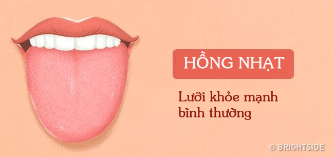 Bằng cách kiểm tra lưỡi mỗi ngày, rất có thể bạn sẽ phát hiện sớm những căn bệnh mình đang gặp phải - Ảnh 1.