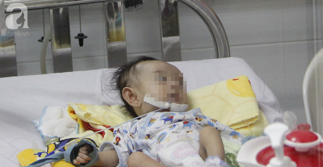 TP.HCM: Phẫu thuật, cứu sống bé gái bị bệnh tim cực hiếm, lần đầu tiên gặp ở Việt Nam - Ảnh 1.