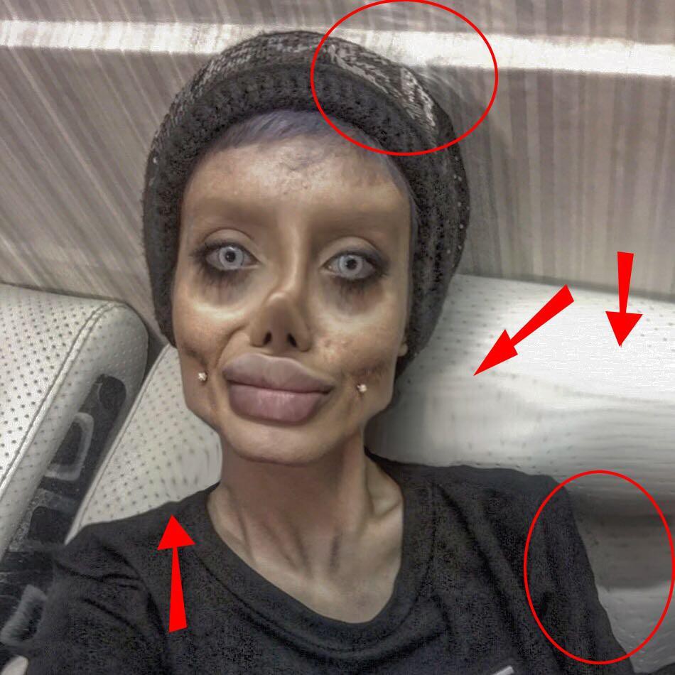Photos of a girl who had surgery 50 times to look like Angelina Jolie were exposed - Photo 6.