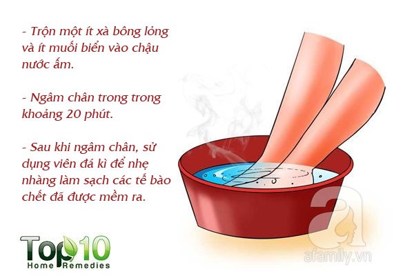 7 mẹo hàng đầu giúp bạn không bị nhiễm trùng và nứt gót chân trong mùa đông này - Ảnh 3.