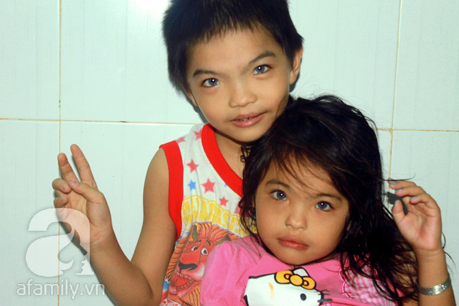 Hai em bé câm điếc có đôi mắt màu xanh bí ẩn ở Sài Gòn đã nghe được những thanh âm đầu tiên - Ảnh 2.