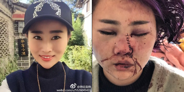 Trung Quốc: Đang ăn BBQ, các cô gái xinh đẹp bất ngờ bị nhóm nam giới say rượu đánh đập, tấn công dã man - Ảnh 1.
