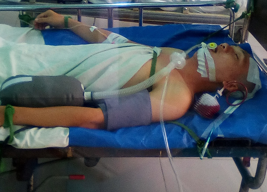 Tai nạn khó tin khi nằm võng ngày mùng 3 Tết - Ảnh 1. Tai nạn khó tin khi nằm võng ngày mùng 3 Tết - Ảnh 1.