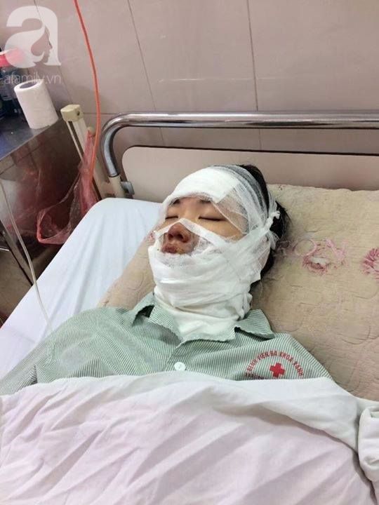 Ngoài cô gái bị bỏng do 55 quả bóng bay, tại Hà Nội có 2 người khác cũng vừa bị bỏng vì lí do này - Ảnh 2.