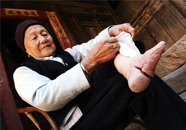 Bó chân gót sen: Khi cái giá của sắc đẹp là những đôi chân rỉ máu và biến dạng cả đời - Ảnh 1.