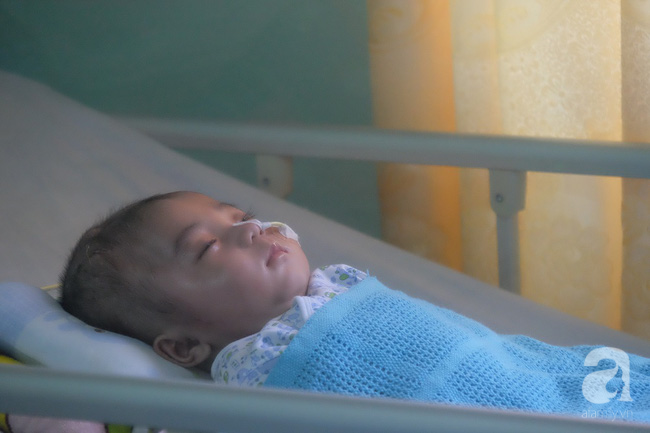 Em bé bị não úng thuỷ được đưa sang Singapore lần 2 để tiểu phẫu - Ảnh 3.