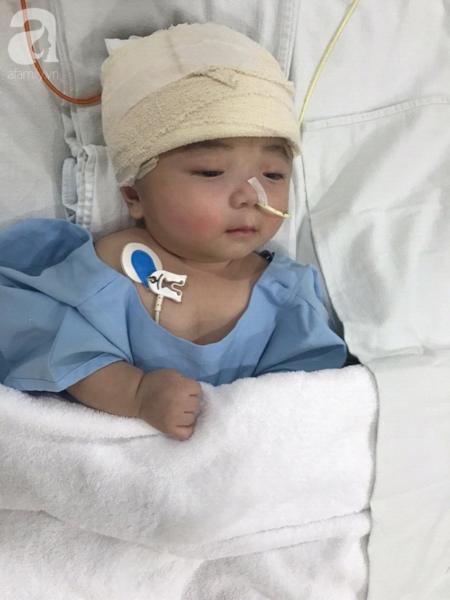 Một ngày sau cuộc tiểu phẫu, em bé não úng thuỷ Phạm Đức Lộc đã biết mở mắt, cử động tay chân - Ảnh 3.