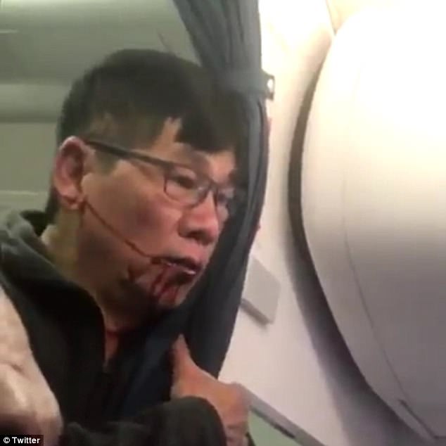 Chân dung bác sĩ người Mỹ gốc Việt bị nhân viên hàng không hãng United Airlines lôi khỏi máy bay - Ảnh 1. Chân dung bác sĩ người Mỹ gốc Việt bị nhân viên hàng không hãng United Airlines lôi khỏi máy bay - Ảnh 1.