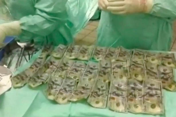 Cãi nhau với chồng, vợ nuốt chửng 7.000USD để giấu tiền - Ảnh 2. Cãi nhau với chồng, vợ nuốt chửng 7.000USD để giấu tiền - Ảnh 2.