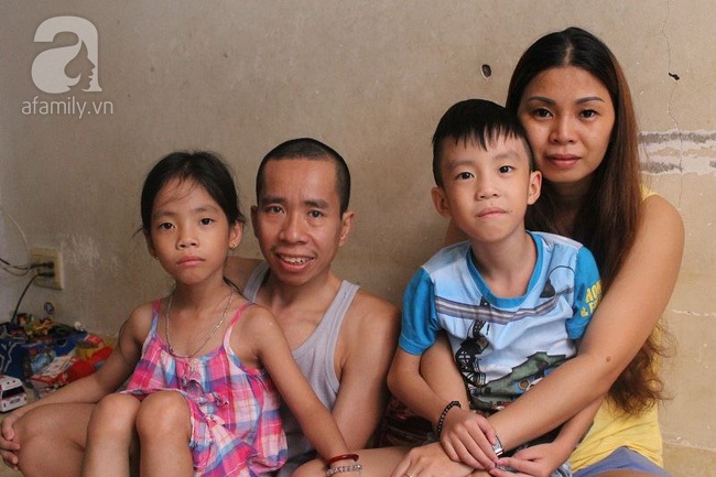 Người em trong cặp song sinh Việt - Đức phải phẫu thuật tạo hình niệu quản - Ảnh 3.