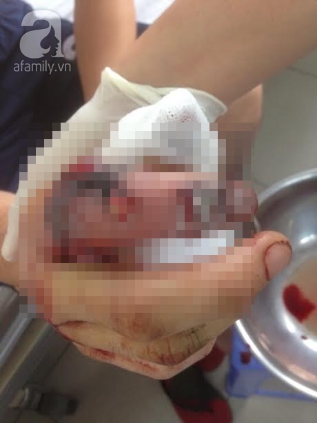 TP.HCM: Một công nhân bị máy xay thịt cắt đứt ngón tay - Ảnh 2.