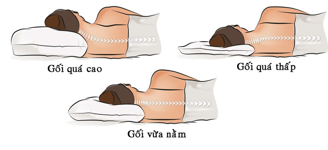 5 thói quen giới trẻ thường mắc phải gây ra chứng thiếu máu não nguy hiểm - Ảnh 1.