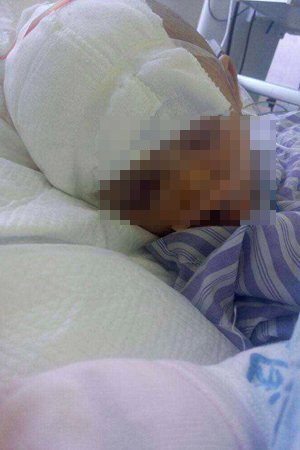 Bé gái 5 tuổi bị người lạ đánh đến hôn mê khi nhận hàng chuyển phát nhanh - Ảnh 1. Bé gái 5 tuổi bị người lạ đánh đến hôn mê khi nhận hàng chuyển phát nhanh - Ảnh 1.