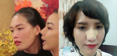 Lộ nghi án Hồng Xuân rời Next Top là vì bị đánh gãy mũi tại nhà chung - Ảnh 5. Lộ nghi án Hồng Xuân rời Next Top là vì bị đánh gãy mũi tại nhà chung - Ảnh 5.