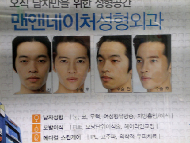 Nam giới Hàn Quốc đua nhau đi phẫu thuật thẩm mỹ để trở thành trai xinh như thần tượng - Ảnh 2.