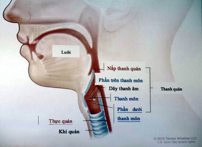 Hi hữu: Một người đàn ông tự nuốt một phần hàm răng giả của mình suốt hai năm mà không biết - Ảnh 4.