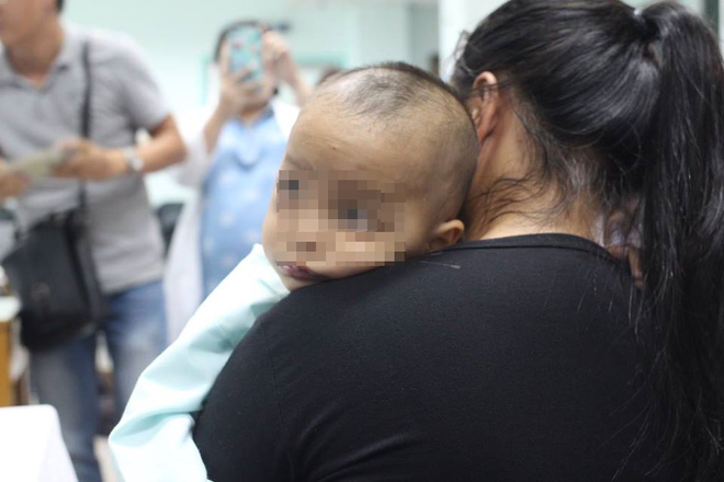TP.HCM: Mẹ chủ quan không điều trị đầy đủ viêm xoang ở mũi cho con, bé trai 16 tháng tuổi suýt mù mắt phải - Ảnh 2.