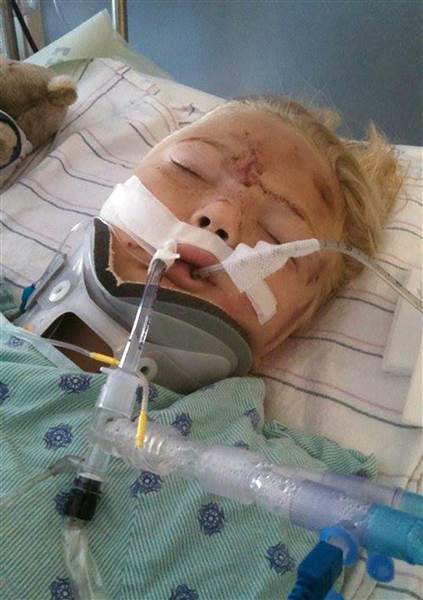 Bé gái 6 tuổi gặp tai nạn, suýt bị cắt đứt đôi người vì một thói lười nguy hiểm của bố mẹ - Ảnh 2.