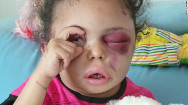 Hình ảnh cô bé 5 tuổi khiến cả thế giới phải sững sờ trước thảm hoạ nhân đạo tại quê hương Yemen - Ảnh 2.