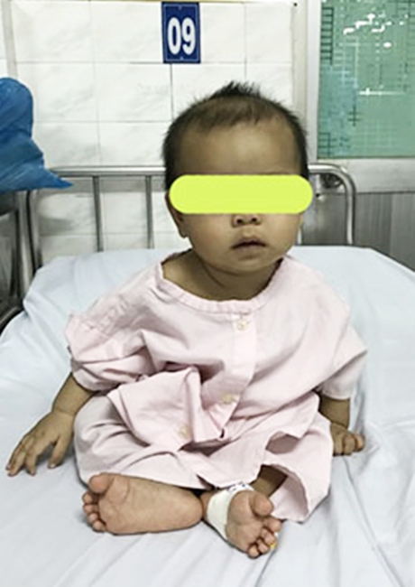 Phụ huynh cẩn trọng: Giật hoa tai của mẹ nuốt vào bụng, bé gái 7 tháng tuổi bị rách thực quản - Ảnh 3. Phụ huynh cẩn trọng: Giật hoa tai của mẹ nuốt vào bụng, bé gái 7 tháng tuổi bị rách thực quản - Ảnh 3.