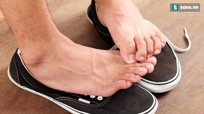 Cậu bé 12 tuổi suýt chết vì nhiễm trùng, lời cảnh báo cho những ai đi giày mà không đi tất - Ảnh 1. Cậu bé 12 tuổi suýt chết vì nhiễm trùng, lời cảnh báo cho những ai đi giày mà không đi tất - Ảnh 1.