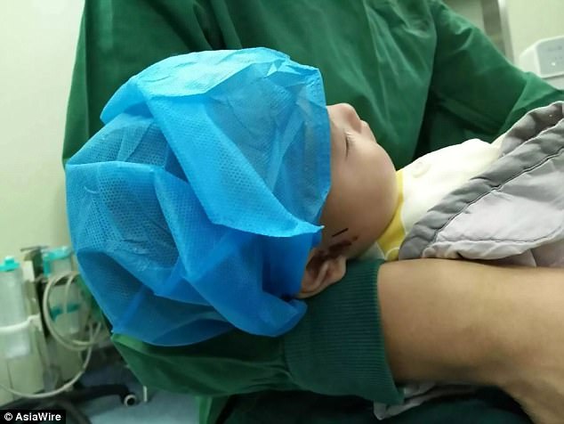 Bé trai 8 tháng lĩnh trọn mũi tên vào mặt, nghi do hàng xóm trả thù - Ảnh 1. Bé trai 8 tháng lĩnh trọn mũi tên vào mặt, nghi do hàng xóm trả thù - Ảnh 1.