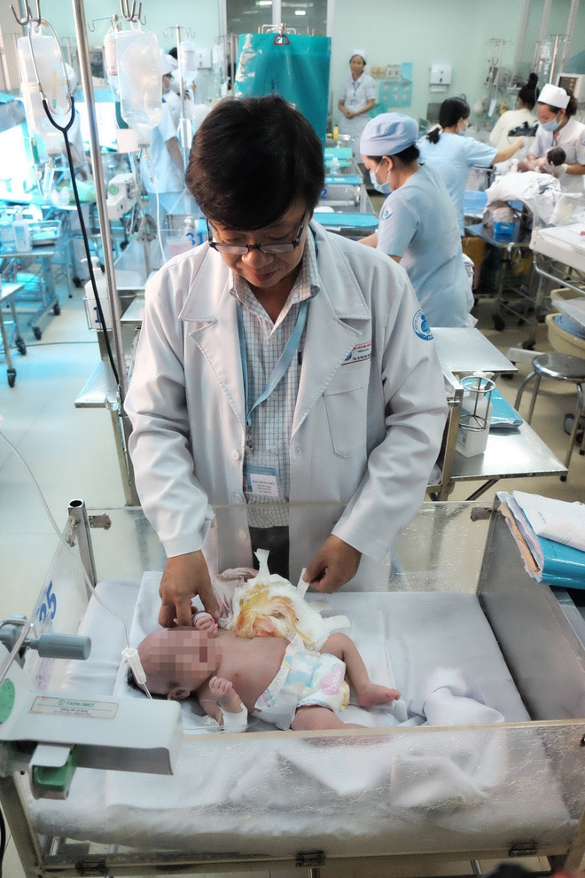 TP.HCM: Vừa chào đời, bé gái đã mang khối u khủng trên cơ thể khiến tính mạng nguy hiểm - Ảnh 5.