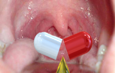 Thuốc trị bệnh ở tai mũi họng: Những lưu ý đặc biệt khi dùng - Ảnh 1.