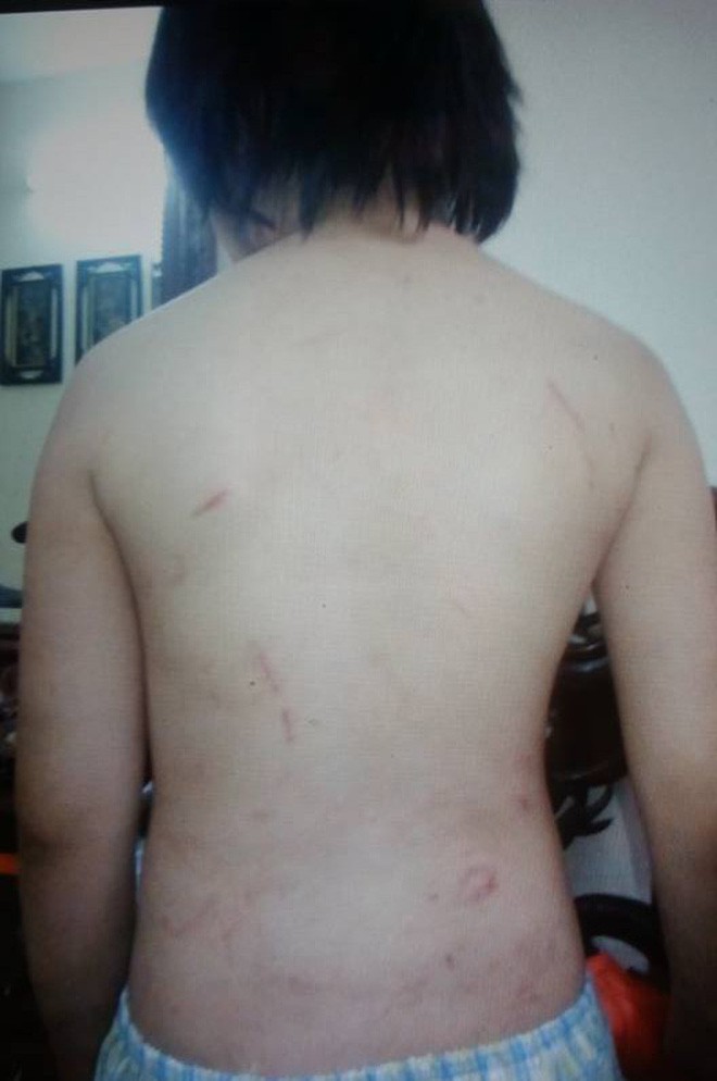 Mẹ kế khai nhận toàn bộ hành vi đánh đập, bạo hành cháu bé 10 tuổi ở Hà Nội - Ảnh 2.
