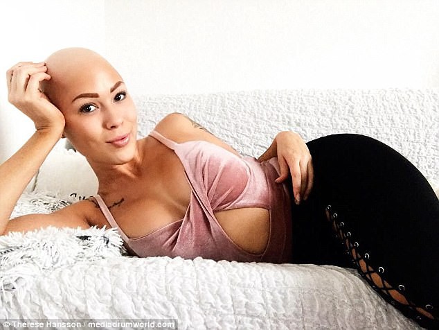 Tưởng mình bị ung thư khi tóc rụng dần, 12 năm sau, cô trở thành một người mẫu xinh đẹp với chiếc đầu trọc lóc - Ảnh 3.