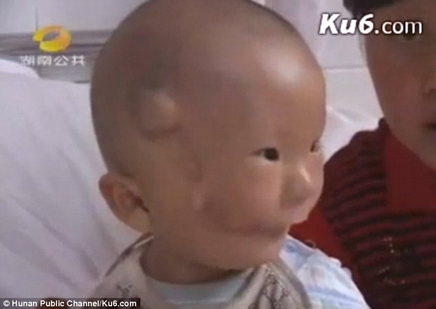 Cậu bé hai mặt lúc nào cũng như đang đeo mặt nạ từ lúc mới sinh - Ảnh 3.