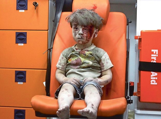 2 cô bé sinh đôi thiệt mạng trong vụ tấn công hóa học ở Syria hay số phận bi thảm của rất nhiều đứa trẻ - Ảnh 3.