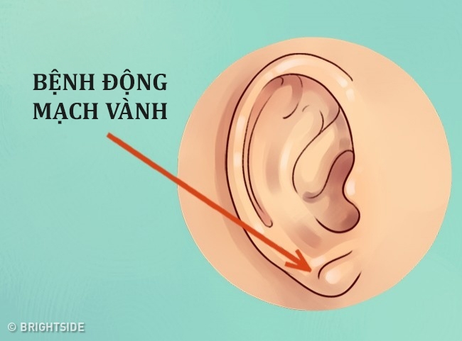 Đừng xem thường, tai không chỉ để nghe và xem tướng mà còn chẩn bệnh được đấy - Ảnh 3.