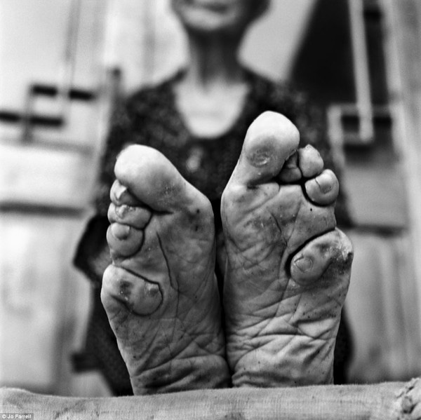 Bó chân gót sen: Khi cái giá của sắc đẹp là những đôi chân rỉ máu và biến dạng cả đời - Ảnh 4.