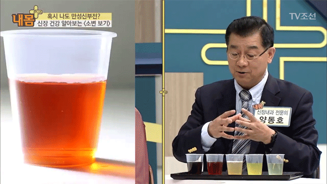 Bác sĩ Hàn Quốc hướng dẫn cách nhìn tình trạng nước tiểu xác định xem cơ thể đang mắc bệnh gì - Ảnh 4.