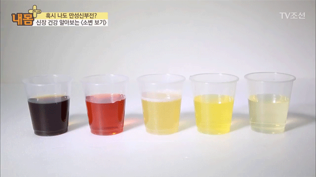 Bác sĩ Hàn Quốc hướng dẫn cách nhìn tình trạng nước tiểu xác định xem cơ thể đang mắc bệnh gì - Ảnh 5.