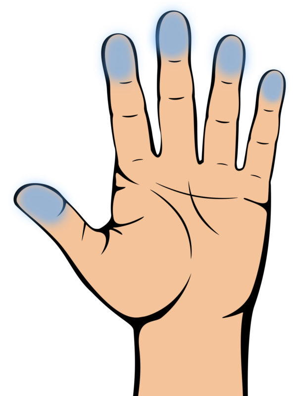 Nhìn ngón tay để biết bệnh tiểu đường hay máu lưu thông không tốt: Kiểm tra rất đơn giản - Ảnh 6.