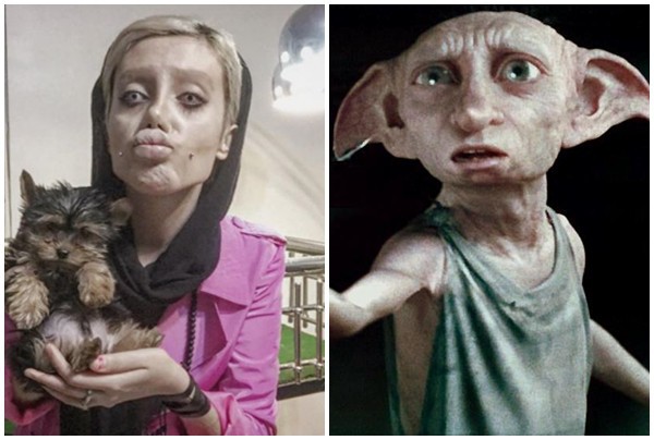 Cô gái phẫu thuật thẩm mỹ hơn 50 lần để nhìn giống Angelina Jolie, kết quả trả về gia tinh Dobby - Ảnh 6.