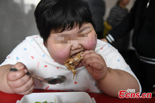 Cuộc sống của cô bé 7 tuổi nặng 75kg, có tháng tăng tới 10kg - Ảnh 7.
