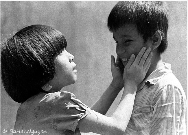 Chuyện của nhiếp ảnh gia 60 tuổi ở Sài Gòn được tái sinh sau 17 ca phẫu thuật vì bỏng lửa - Ảnh 9.