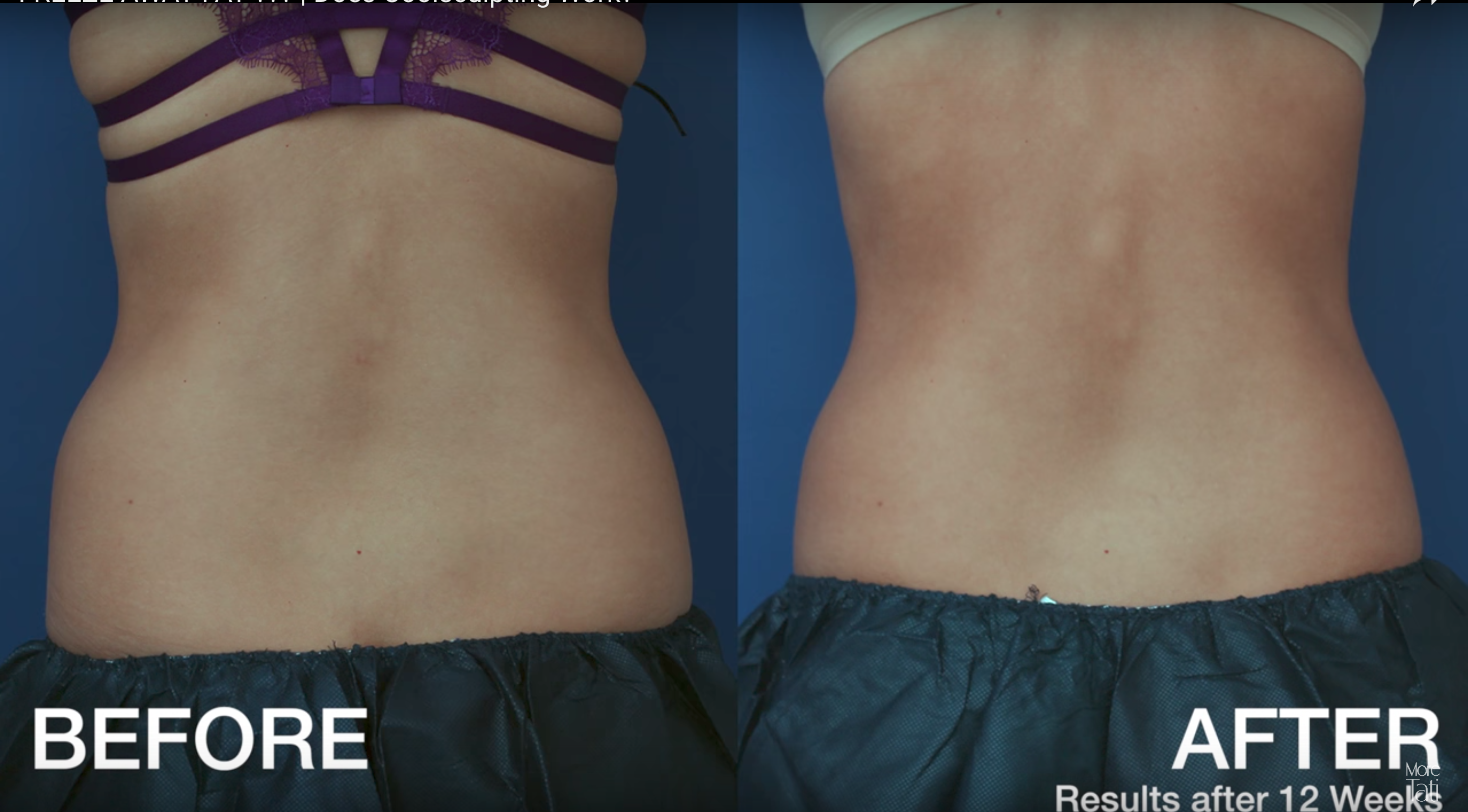 Hai phương ph&aacute;p giảm c&acirc;n Slimming Body đang hot nhất hiện nay - Ảnh 9.