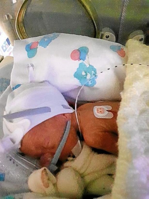 Khao khát có thêm con, mẹ khá sốc nghe bác sĩ bảo phải sinh sớm 10 tuần chỉ vì thai kì quá hiếm - Ảnh 5. Khao khát có thêm con, mẹ khá sốc nghe bác sĩ bảo phải sinh sớm 10 tuần chỉ vì thai kì quá hiếm - Ảnh 5.