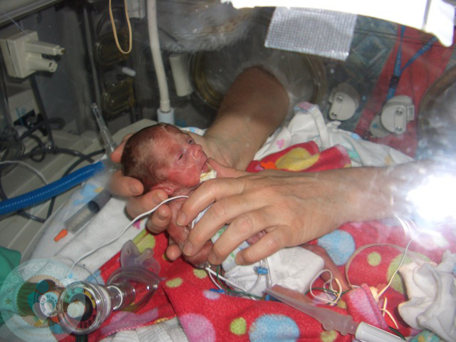 Bất chấp quy tắc, nữ y tá đặt bé sơ sinh hấp hối nằm cạnh chị sinh đôi, tạo nên kết quả chấn động - Ảnh 1.