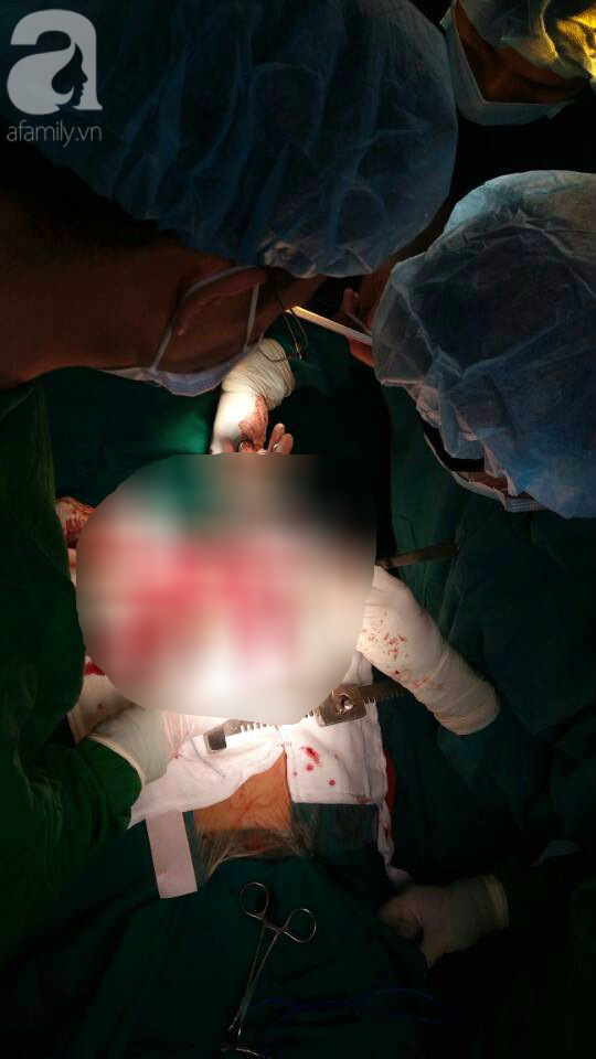 TP.HCM: Một bệnh nhân vỡ tim do tai nạn giao thông được cứu sống - Ảnh 1.