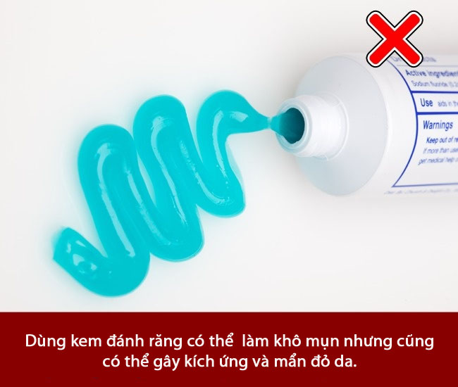 6 sai lầm khi trị mụn trứng cá khiến mụn mọc nhiều hơn và hủy hoại làn da bạn nhanh chóng - Ảnh 8.