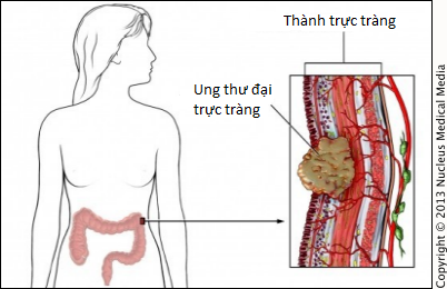 Mới 35 tuổi, bà mẹ 2 con xinh đẹp phải chiến đấu với những cơn hành hạ trong giai đoạn cuối của bệnh ung thư - Ảnh 6.