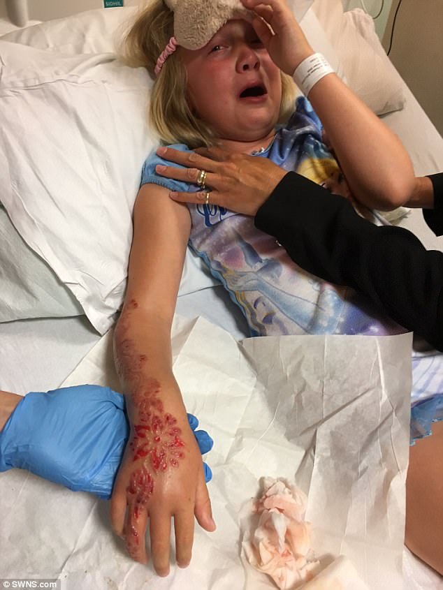 Được bố thưởng cho vẽ henna lên tay, bé gái 7 tuổi đã phải khóc đau đớn khi cánh tay bỏng rộp đáng sợ - Ảnh 4.