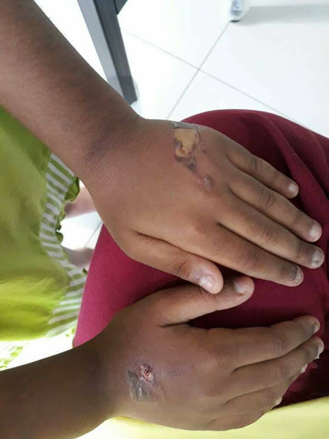 Bé gái 6 tuổi bị bà ngoại đánh đập dã man vì đánh đổ thức ăn ra bàn - Ảnh 2.