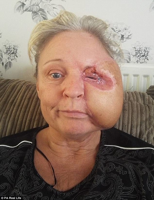 Sau một lần đập đầu vào lò vi sóng, gương mặt người mẹ xinh đẹp bỗng biến dạng khủng khiếp thế này - Ảnh 4. Sau một lần đập đầu vào lò vi sóng, gương mặt người mẹ xinh đẹp bỗng biến dạng khủng khiếp thế này - Ảnh 4.